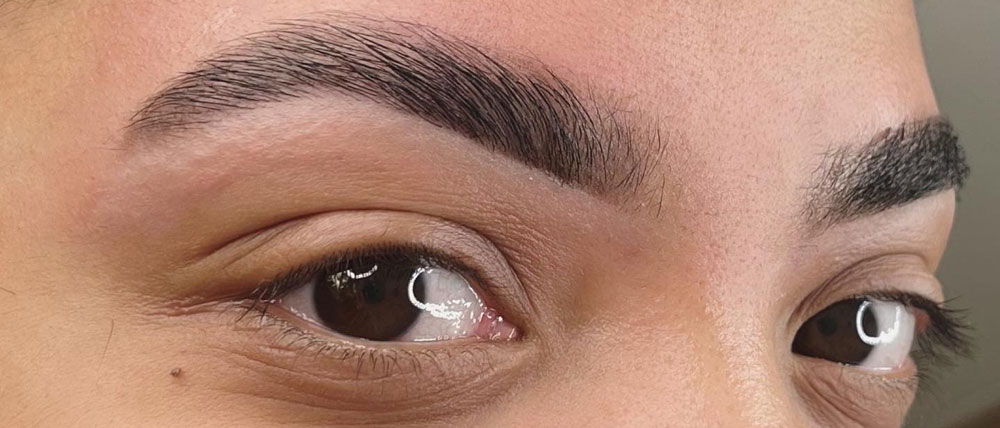 After brow treatment