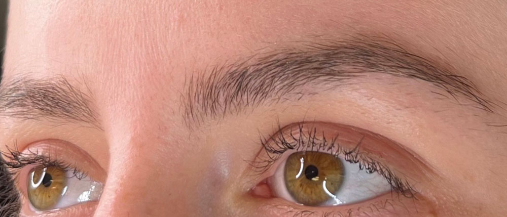 Before brow treatment